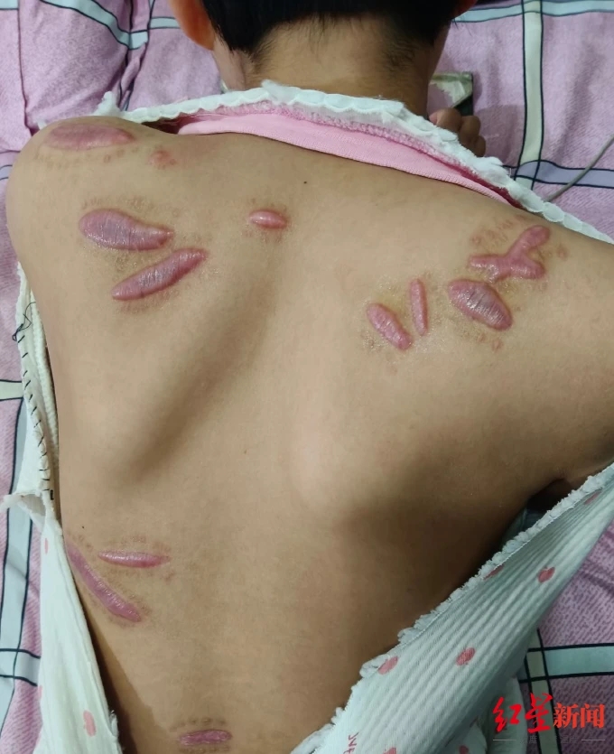 9岁女童被邻居家砍伤:伤者未满14周岁不能追究刑事责任,道歉不赔偿